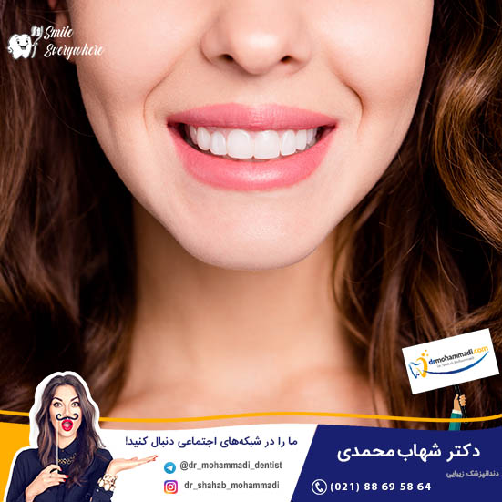 مقایسه ترمیم لب پریدگی دندان جلو با کامپوزیت نسبت به سایر روش ها - کلینیک دندانپزشکی دکتر شهاب محمدی